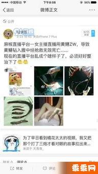 琪琪女主播zw视频